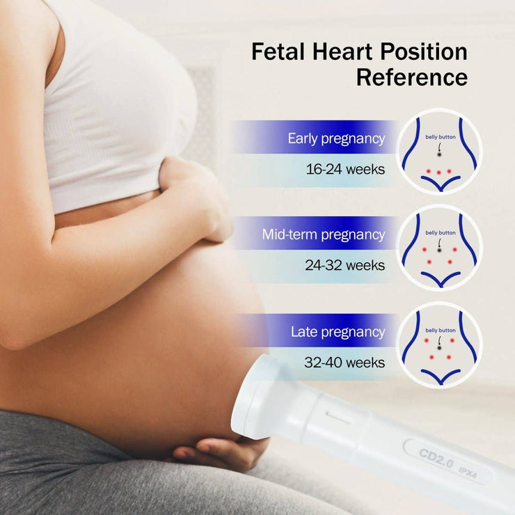 SpringBud FD-300B Fetal Doppler Baby Heartbeat Monitor